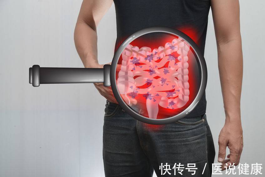 结肠癌患者饮食上要注意什么(患有结肠癌，饮食要注意这5个原则，或能稳定病情减少发作)