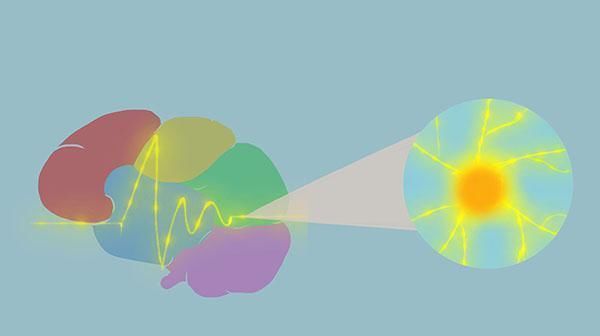  脑梗|脑梗发作跟什么有关？发作症状是什么？