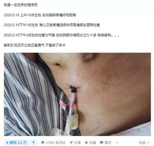  忍不住|员工加班累到做手术，复工第一周又让加班，小伙终于忍不住爆发了