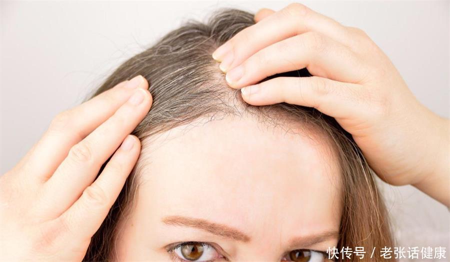 年纪轻轻长白头发怎样让白发变少(为何年纪轻轻就长白头发？年轻人的白发该如何改善？不妨看看)