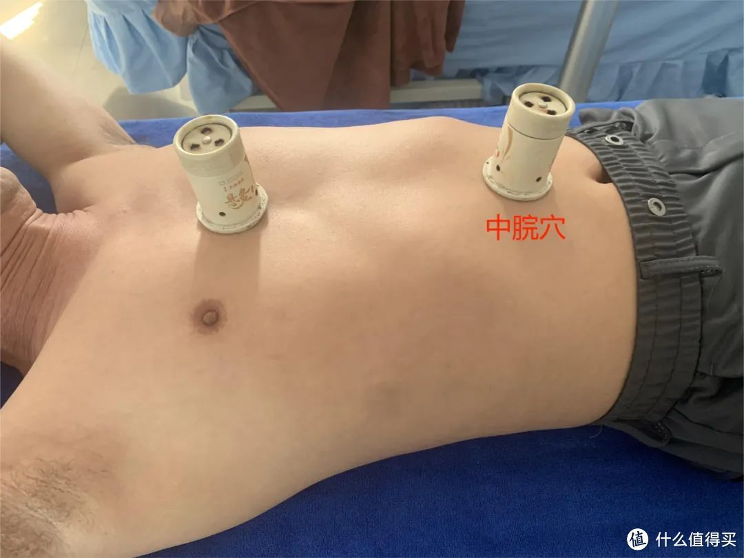 秋季艾灸正当时(秋季艾灸正当时！)