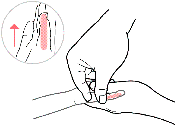  腹泻|宝宝消化不良（腹泻）了怎么办？