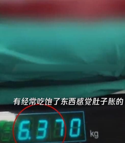  男子|男子一口冰啤下肚突感不适，肚子离奇胀大，医生的话让男子慌了