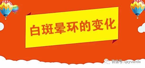 白癜风|白癜风有没有扩散？看这4点就可以了！