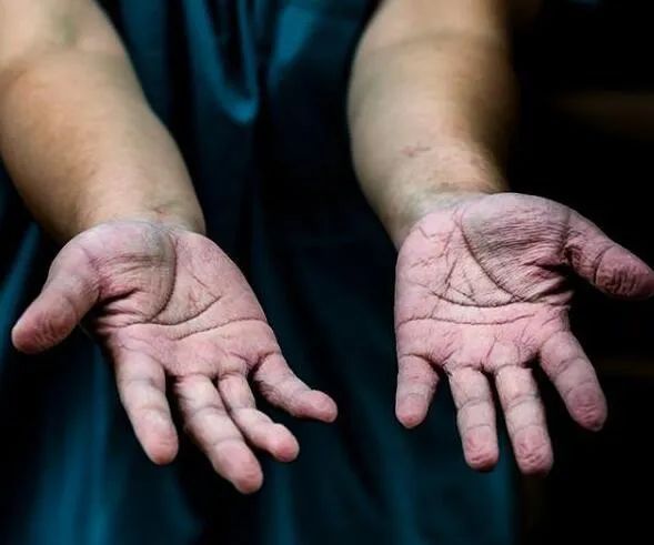  最美|致敬“最美面孔”请记住她们！