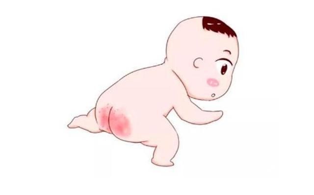  宝宝|宝宝红屁股怎么样好得快？你或许真的不知道，看看育儿专家的理解