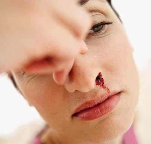 鼻子经常出血要小心,是身体发出的5大\
