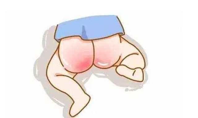  宝宝|宝宝红屁股怎么样好得快？你或许真的不知道，看看育儿专家的理解