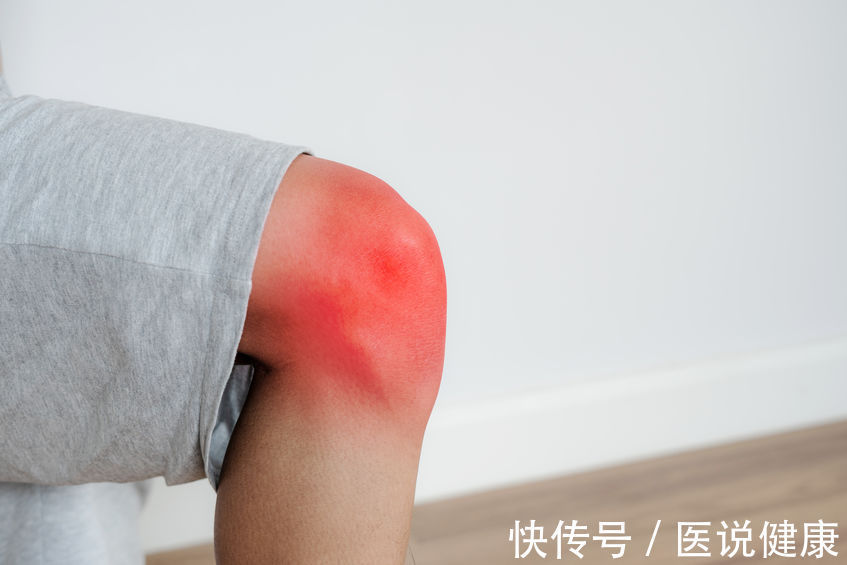 尿酸过高的原因及改善方法(尿酸过高的人，身体或出现这4个症状，注意这3点或能降尿酸)