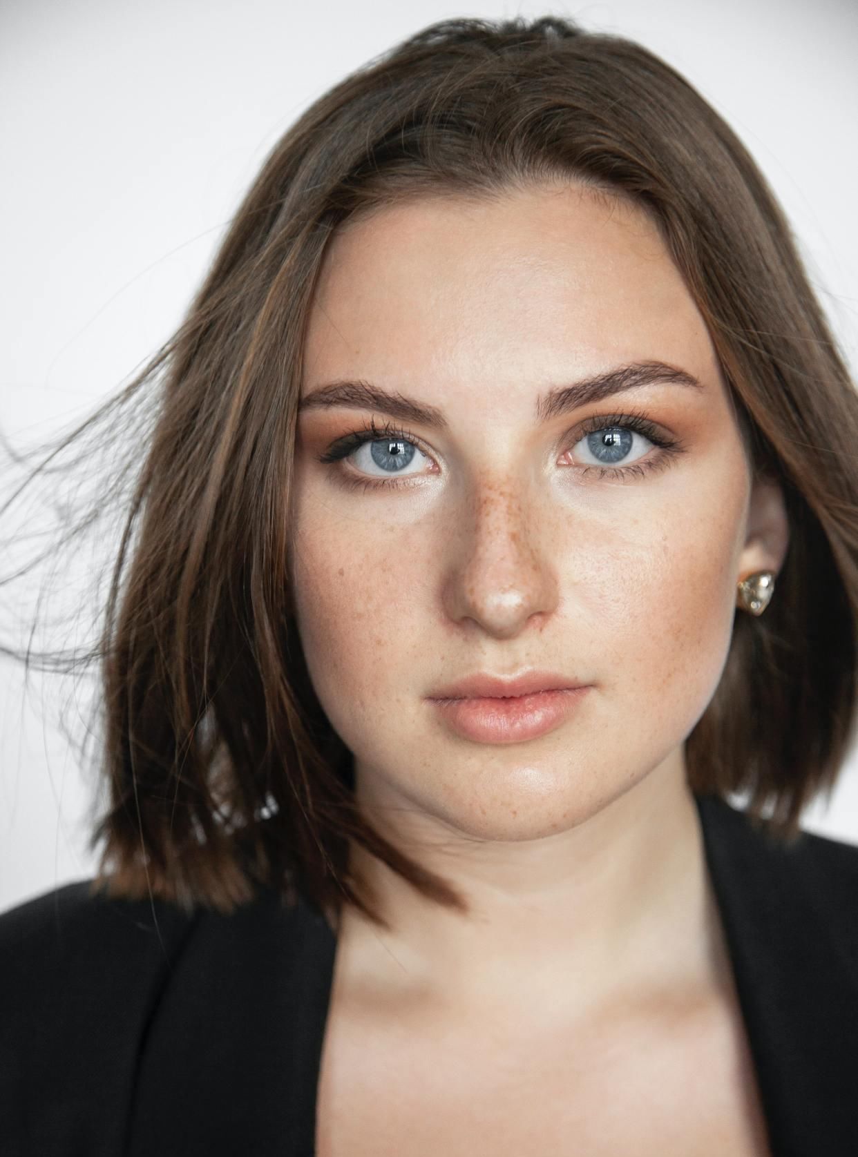  接触性皮|皮肤易过敏？多吃这个水果就够了