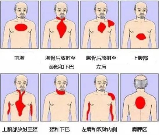 医生|头晕、牙疼、肩膀疼也要查心电图？医生：这六种症状心脏检查要“加项”，一表把“哪些人需要做”梳理清了