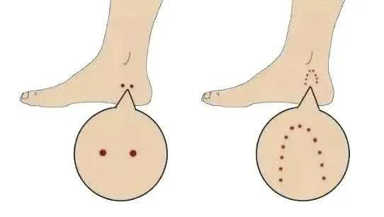  出没|当心！有蛇出没！