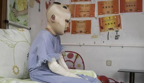  女孩|偷油贼焚车引发车祸致1死2伤，疑犯归案10岁女孩却惨遭毁容