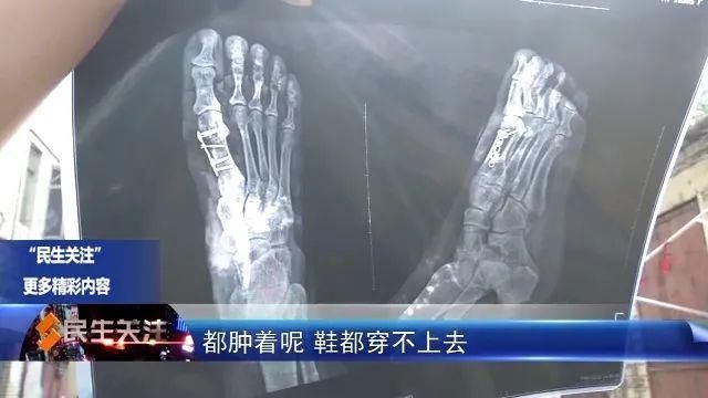  常女士|送餐途中出意外 理赔问题起纠纷