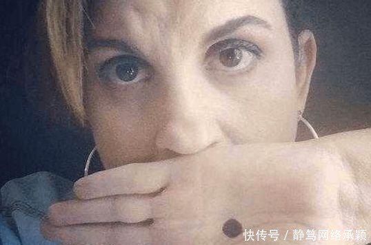 自拍照|女子网上发了张手掌上有黑点的自拍照, 朋友看到后却立刻报了警