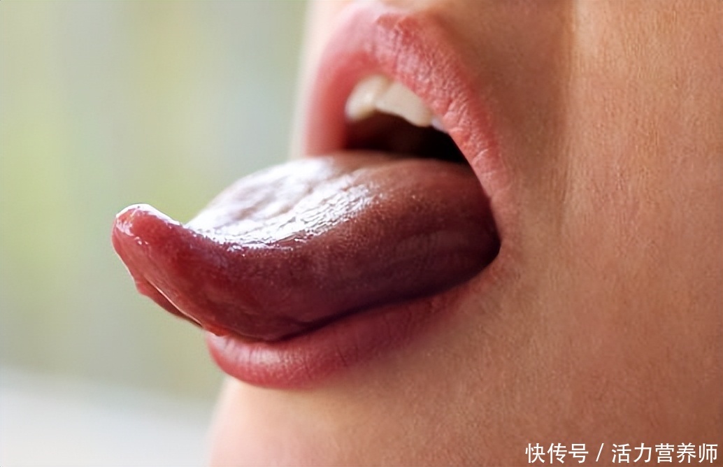 中医讲人有三黄寿命不长(俗语“人有三黄，寿命不长”，这里说得到底是什么？别再误会了)