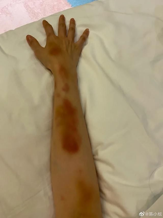  爆炸|凭“双料冠军”美爆炸热搜的她，才不是无辜“被绿”的傻白甜