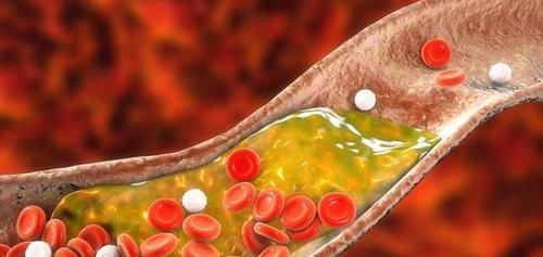  决明子|男人常用决明子泡水喝，让你尝到3个“甜头”！但要避开6个禁忌