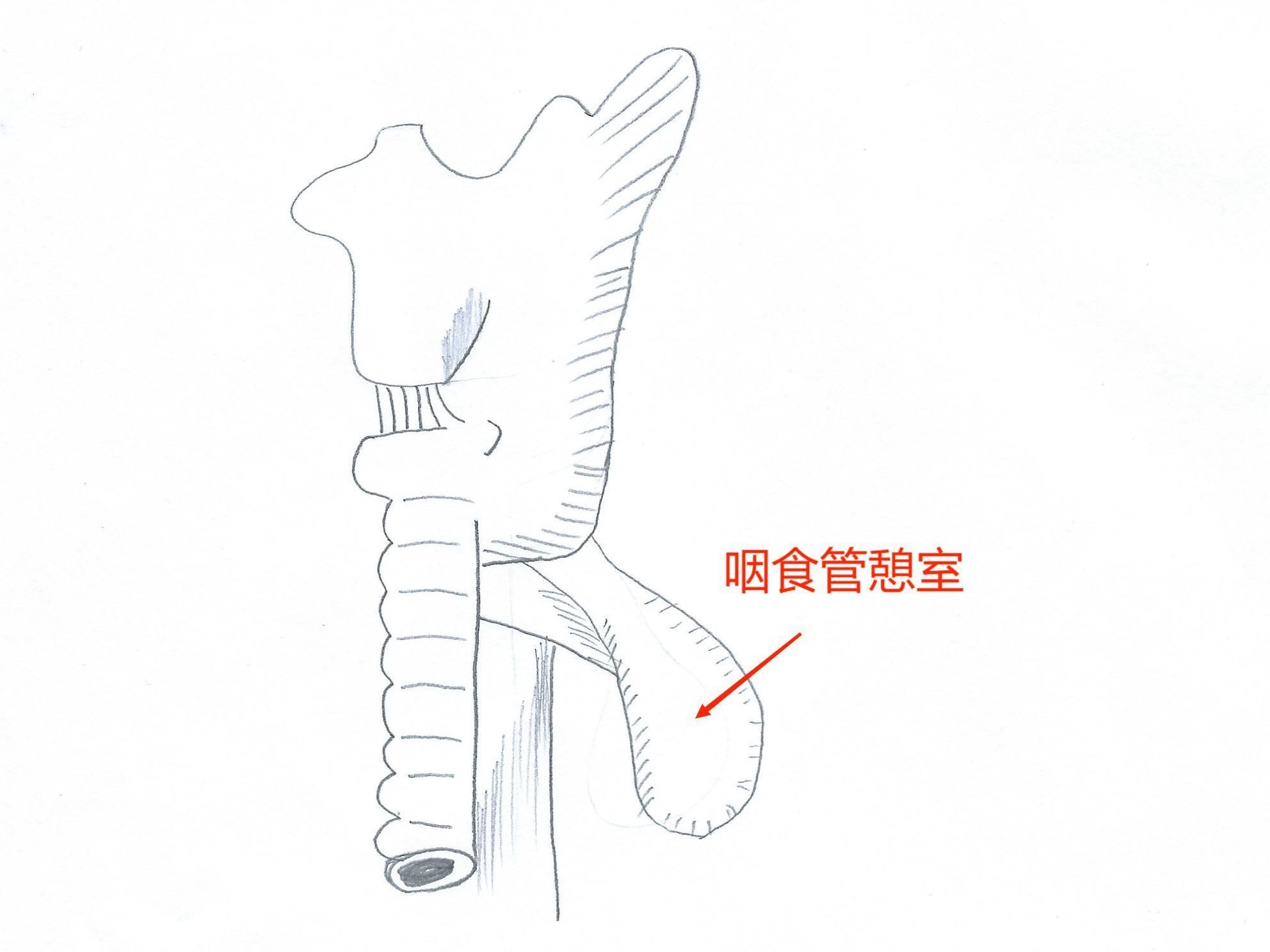 进食困难暴瘦30斤的齐阿姨，“生命管道”在这里重塑2023
