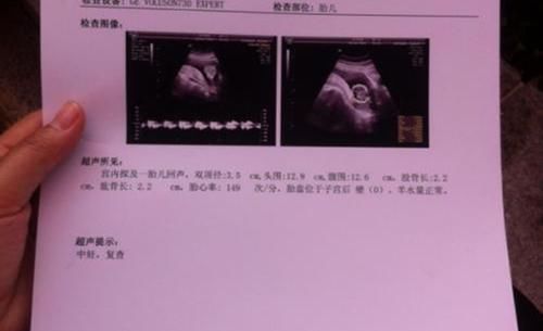 怀孕|“假孕妈”被逼让座，一张纸的“无意”飘落，让在场众人哑言