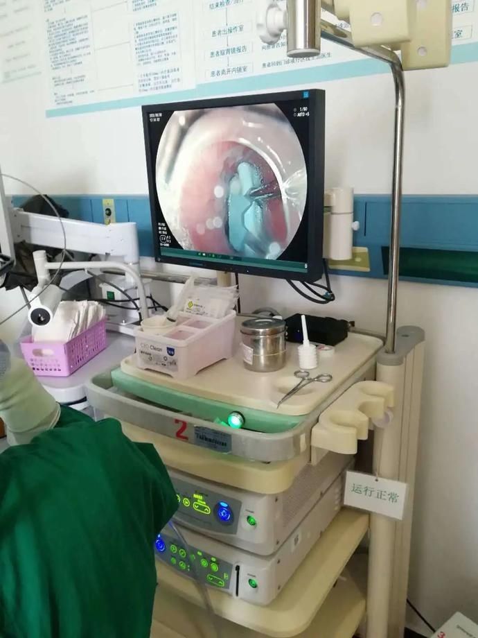  危险|危险！广南一人冲动吞下一枚燕尾夹