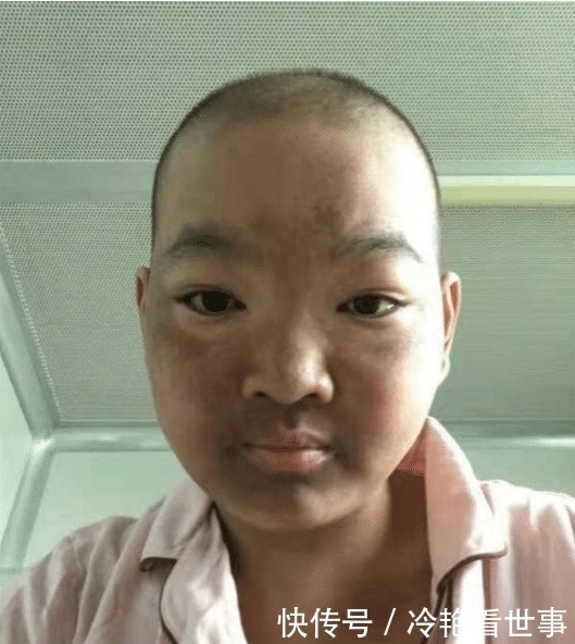 做法|“村花”嫁给穷小伙, 不幸患病“毁容”后对方的做法令人落泪