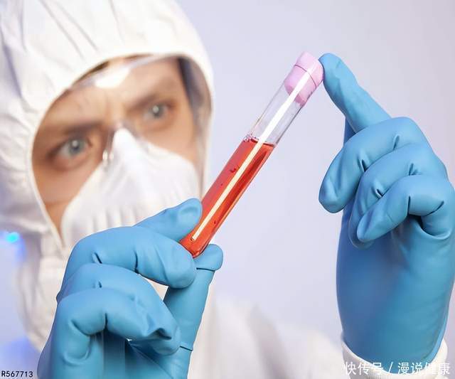 抽血哪个指标可以看出癌(体内有癌，抽血便知？血常规这3种指标，还真能查出“蛛丝马迹”)