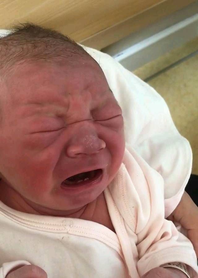  医生|这婴儿生下来有两颗牙母亲很自豪，但医生说你的痛苦才刚刚开始