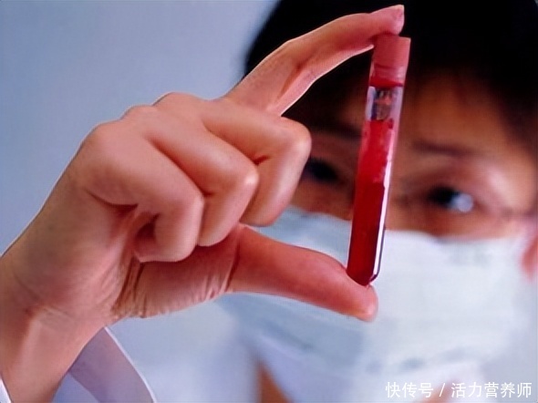 血脂高怎么才能知道降没降下来(血脂高不高，主要看身上这3个部位地方？一旦发现异常要注意降脂)