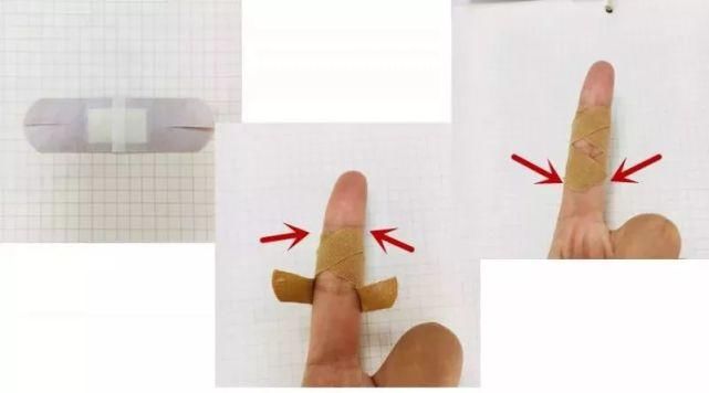  适合|什么伤口用创可贴？这5种不适合