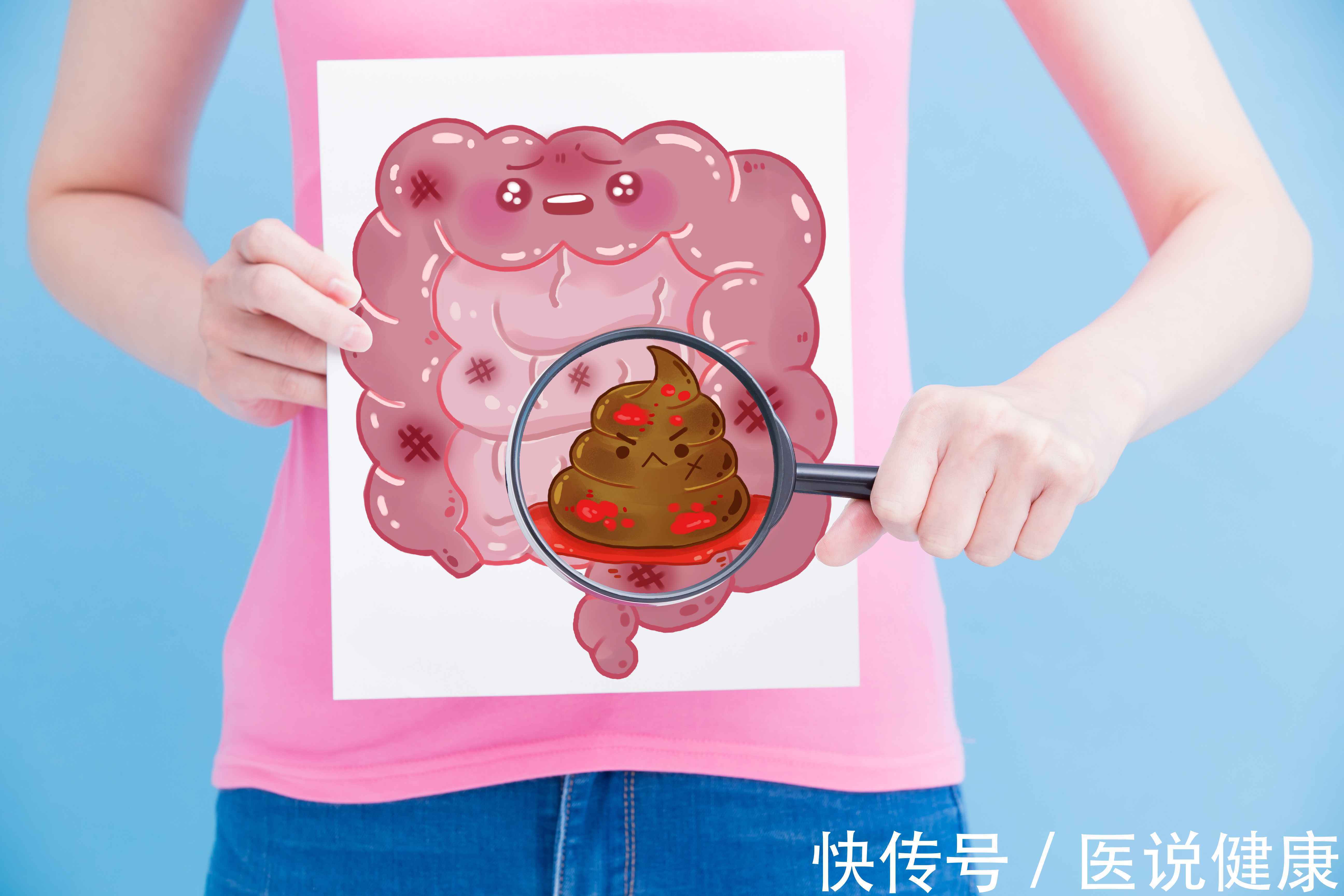 身体出现5个反应是大肠癌的征兆(身体出现这3个症状，或是大肠癌发出的信号，要重视起来)