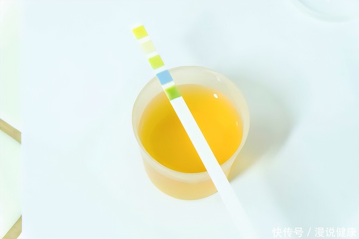 肾不好会引起尿黄吗(肾不好，尿液知？除了肾虚外，引起尿黄的原因还可能与这6点有关)