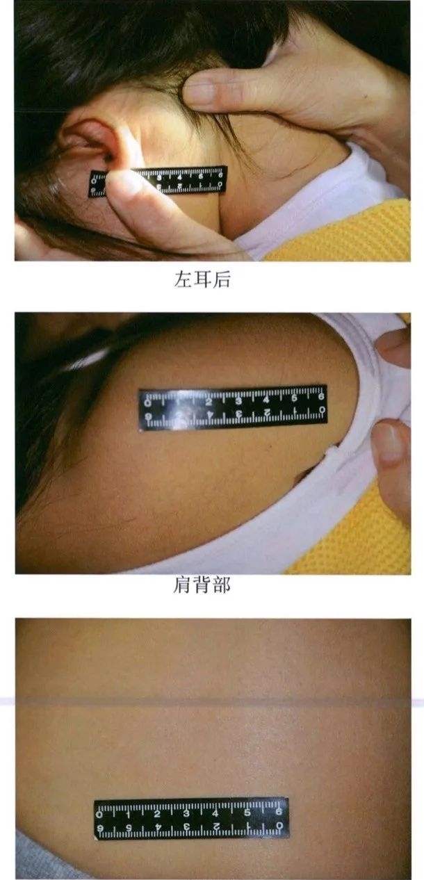 孩子|天津金色摇篮幼儿园针扎虐童案审判:5名幼师均获刑