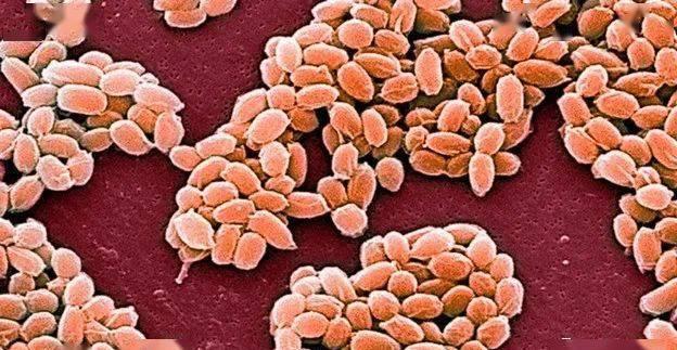 图源|北极圈着火!气温直逼38度,科学家恐冰川融化远古病毒复活