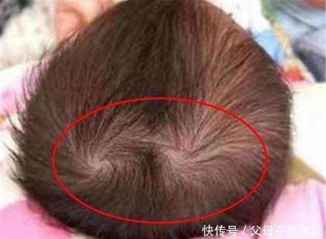 双顶女孩没人要,孩子头顶的旋意味着啥