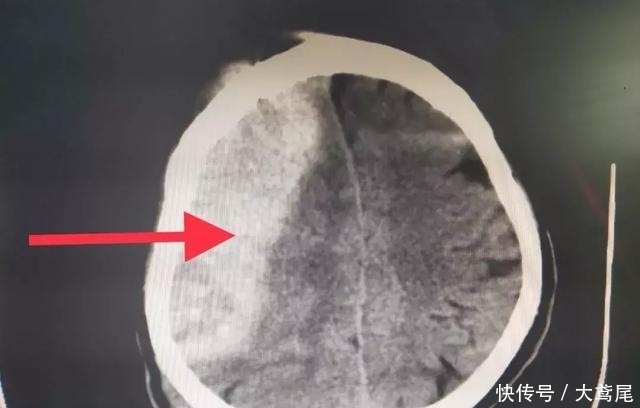  诊室|医生多看一眼，救两条命！非医生曝光，你永远无法看到这幕