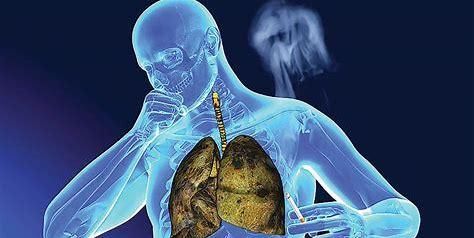 减退|记忆力减退,可能是脑萎缩,如何避免症状加重,医生有话对您说