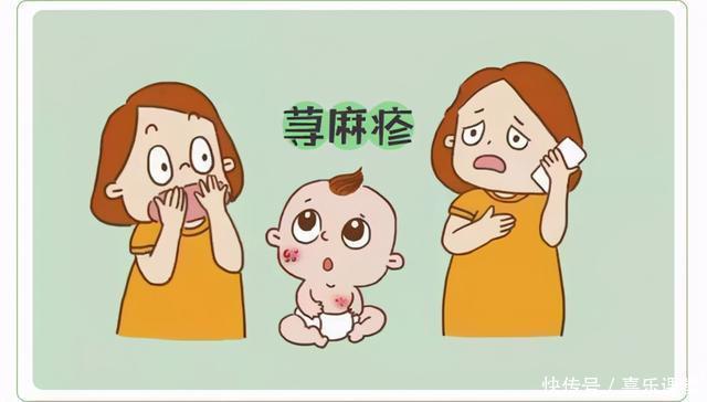 中医:想要治疗荨麻疹,先了解这几点