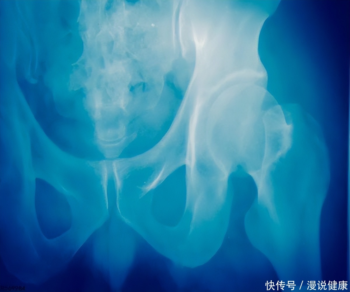 X射线检查会有辐射危险？在做检查之前留意这4点，大可不必操心2023