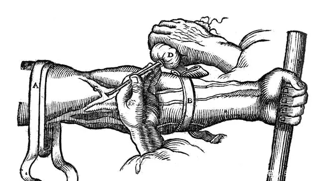  血液里|人类输血的起源：把小牛血输入疯子体内，希望他不再发疯变温柔