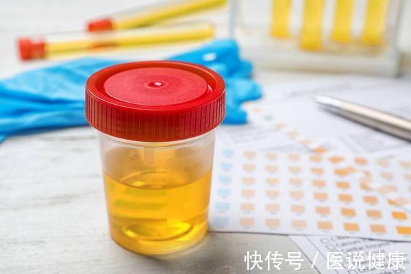 糖尿病眼睛并发症早期有哪些症状(糖尿病患者，出现这5个症状表现，警惕并发症找上门了)