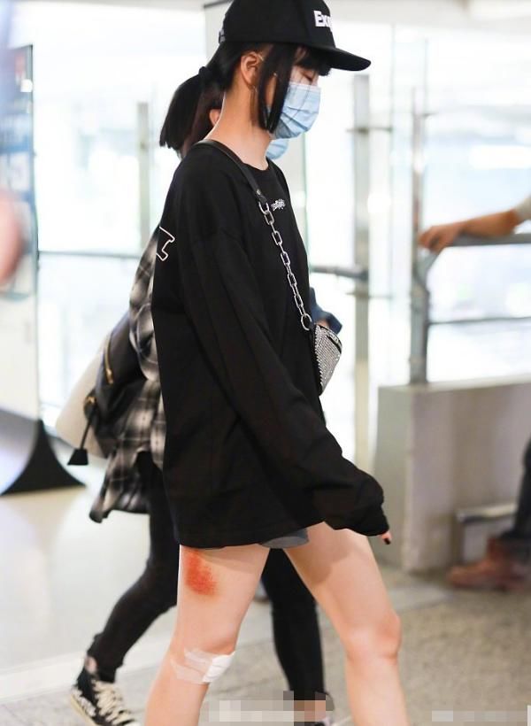 助理|黄龄摔下舞台后首现身,腿部一大片擦伤令人心疼,走路需助理搀扶