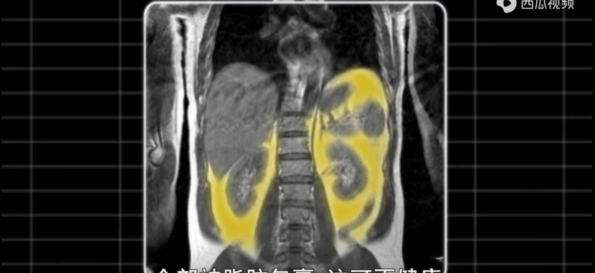  小迈|BBC纪录片《瘦身十律》：减肥你需要知道的十件事