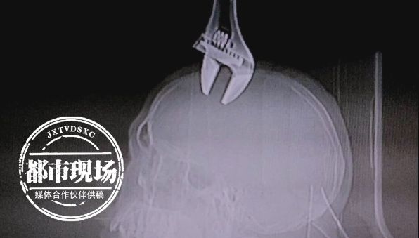  刚好|8楼掉下扳手，男子刚好经过