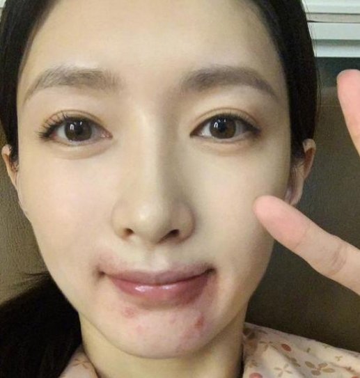  动刀|江疏影脸上动刀？近来频繁营销美貌的她，竟是医学的功劳？