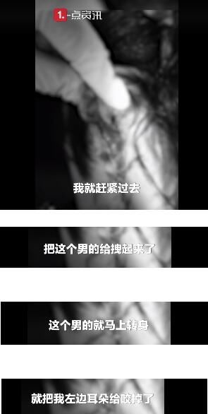  耳朵|男子街头阻止性侵被咬掉耳朵 无法修复只能开颅