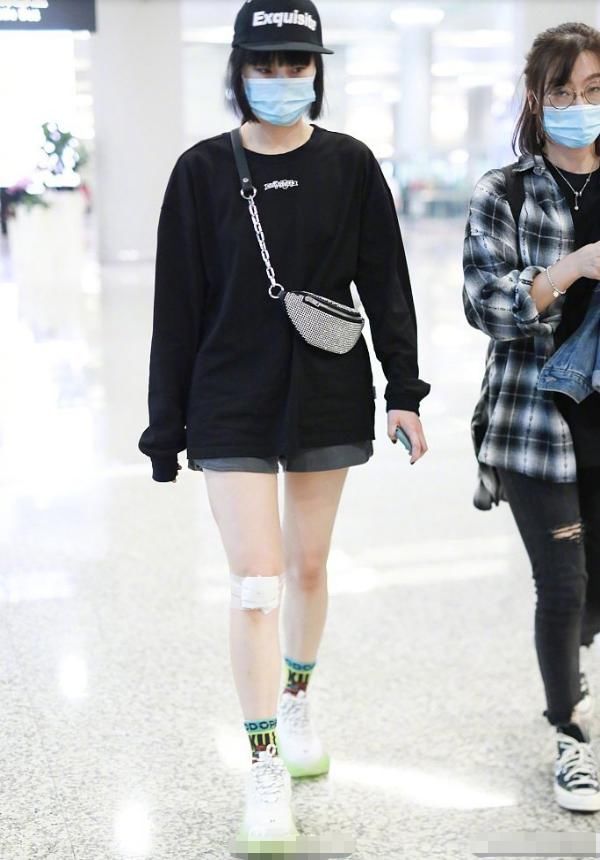 助理|黄龄摔下舞台后首现身,腿部一大片擦伤令人心疼,走路需助理搀扶