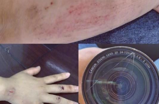 明日|《明日之子》保安又打人?录制现场玻璃破碎,硬糖少女也被牵连