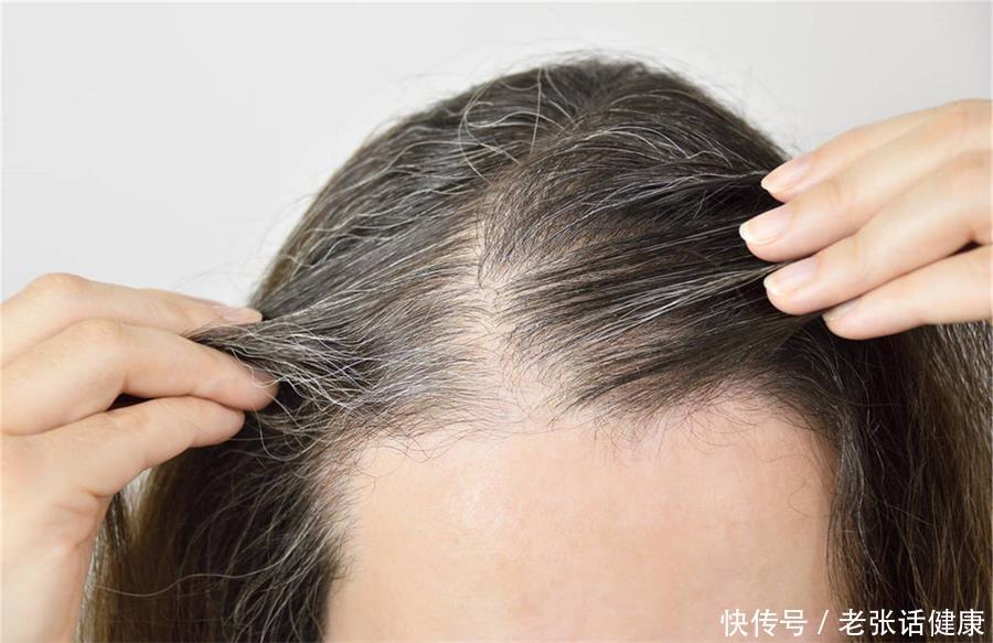 年纪轻轻长白头发怎样让白发变少(为何年纪轻轻就长白头发？年轻人的白发该如何改善？不妨看看)