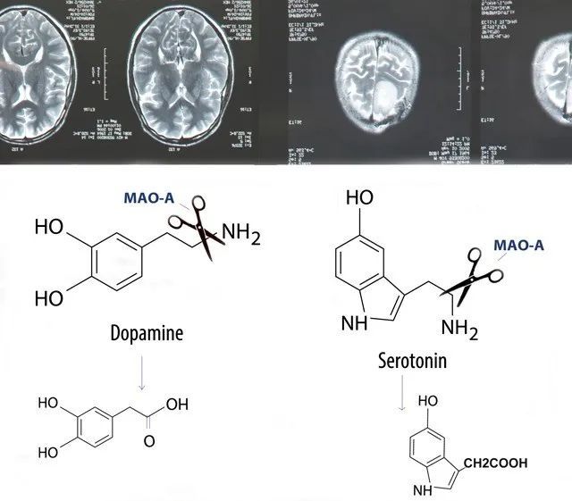  上热|又一起恶性犯罪案件上热搜，真的有「天生的坏人」吗？